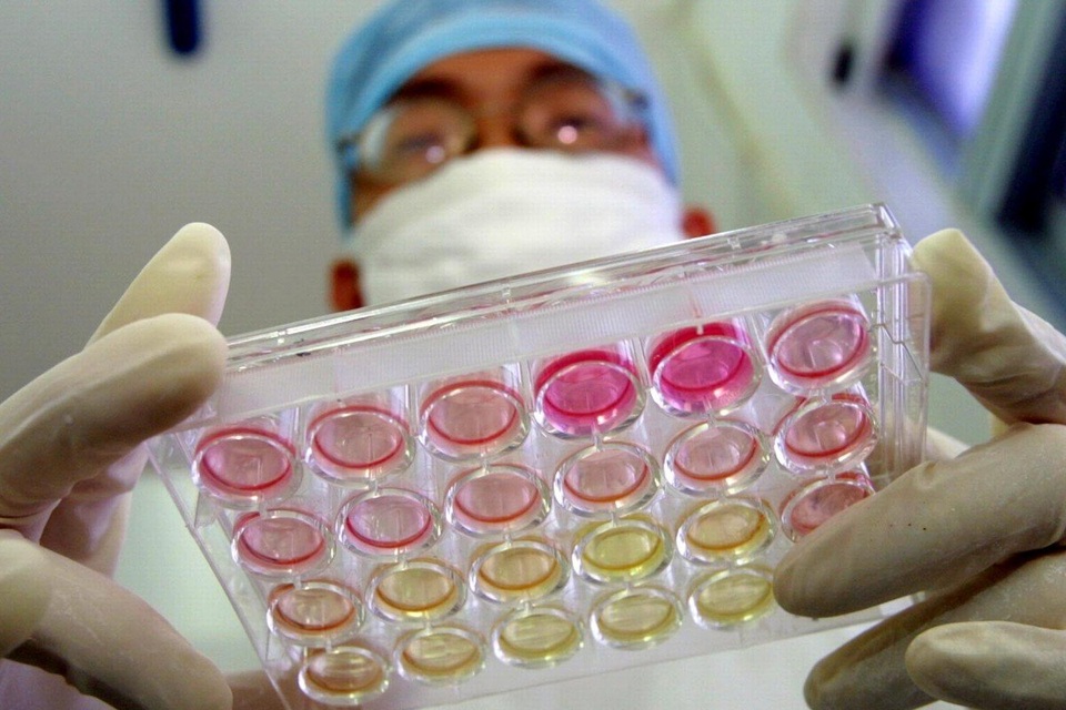 Nghiên cứu: Virus corona có thể đã lây ở người hàng chục năm - 1 Nghiên cứu: Virus corona có thể đã lây ở người hàng chục năm - 1