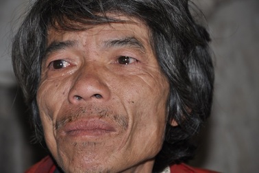 Quan xã ăn chặn cả “gói mì tôm” của người tàn tật