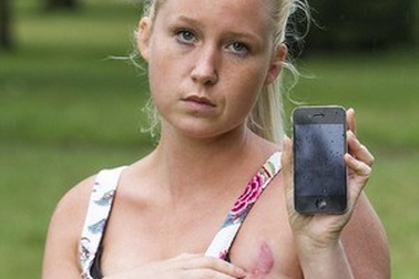 Cô gái bị bỏng ngực vì iPhone bất ngờ tăng nhiệt khi cắm sạc