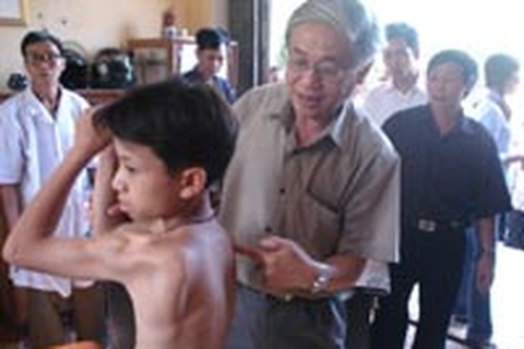 Teo cơ delta - Có thể chữa khỏi?