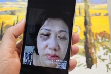 Người phụ nữ bị 2 vợ chồng đánh tại chung cư ở TPHCM