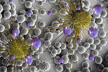 Các nhà khoa học Siberia phát triển một công nghệ mới để điều trị ung thư