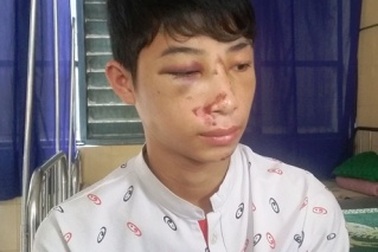 Trưởng Công an xã “bác” thông tin đánh học sinh nhập viện