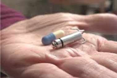 Việt Nam cấy thành công máy tạo nhịp tim không dây siêu nhỏ