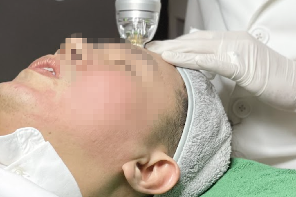 Mang phèn chua lên máy bay để trị hôi nách: Chuyên gia khuyến cáo điều gì? - 3 Mang phèn chua lên máy bay để trị hôi nách: Chuyên gia khuyến cáo điều gì? - 3
