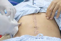 Đứt tụy, vỡ hành tá tràng, người đàn ông mất 2 lít máu