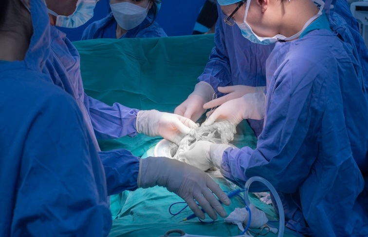 Đau bụng dai dẳng hơn 1 năm vì u mạc treo non gây tắc ruột