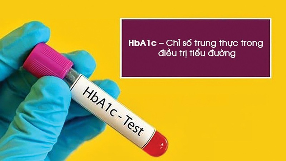 BoniDiabet – “Bảo bối lợi hại” giúp hạ đường huyết và chỉ số HbA1c - 1 BoniDiabet – “Bảo bối lợi hại” giúp hạ đường huyết và chỉ số HbA1c - 1