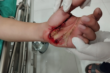 Cứu sống người đàn ông bị điện giật ở Tuyên Quang