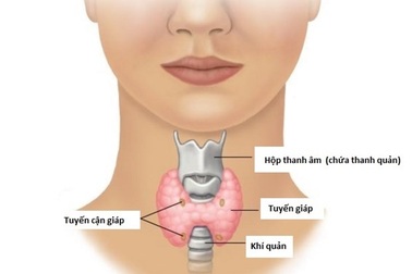 Israel đột phá trong phương pháp phát hiện ung thư tuyến giáp