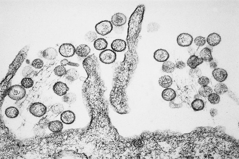 300 ống chứa virus nguy hiểm chết người thất lạc tại Australia - 1