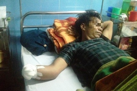 Đốt pháo chơi Tết, 3 người nhập viện cấp cứu