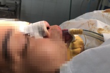 TPHCM: Bị tai biến nặng nề sau khi để người tiêm silicon dạo sửa mũi