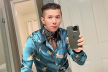 Căn bệnh khiến Kasim Hoàng Vũ bị lệch mặt có nguy hiểm?