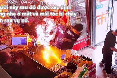 Thanh niên bỏng mặt vì bật lửa bất ngờ phát nổ
