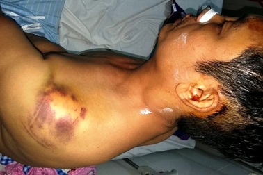 Bị đánh gục, dí súng bắn vào đầu nhưng… giám định thương tật chỉ 10%!?