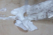 Khó lường nguy cơ từ “thuốc lạ” trong áo ngực