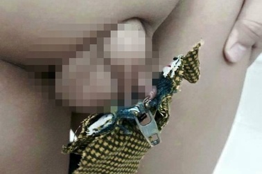 Đừng làm hại cu tí vì mẹ vội kéo khóa quần