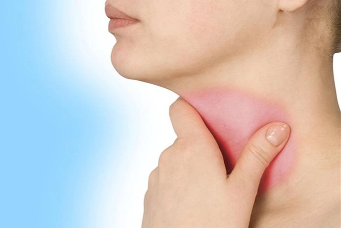 Dấu hiệu viêm họng kéo dài cảnh báo bệnh nguy hiểm - 1 Dấu hiệu viêm họng kéo dài cảnh báo bệnh nguy hiểm - 1