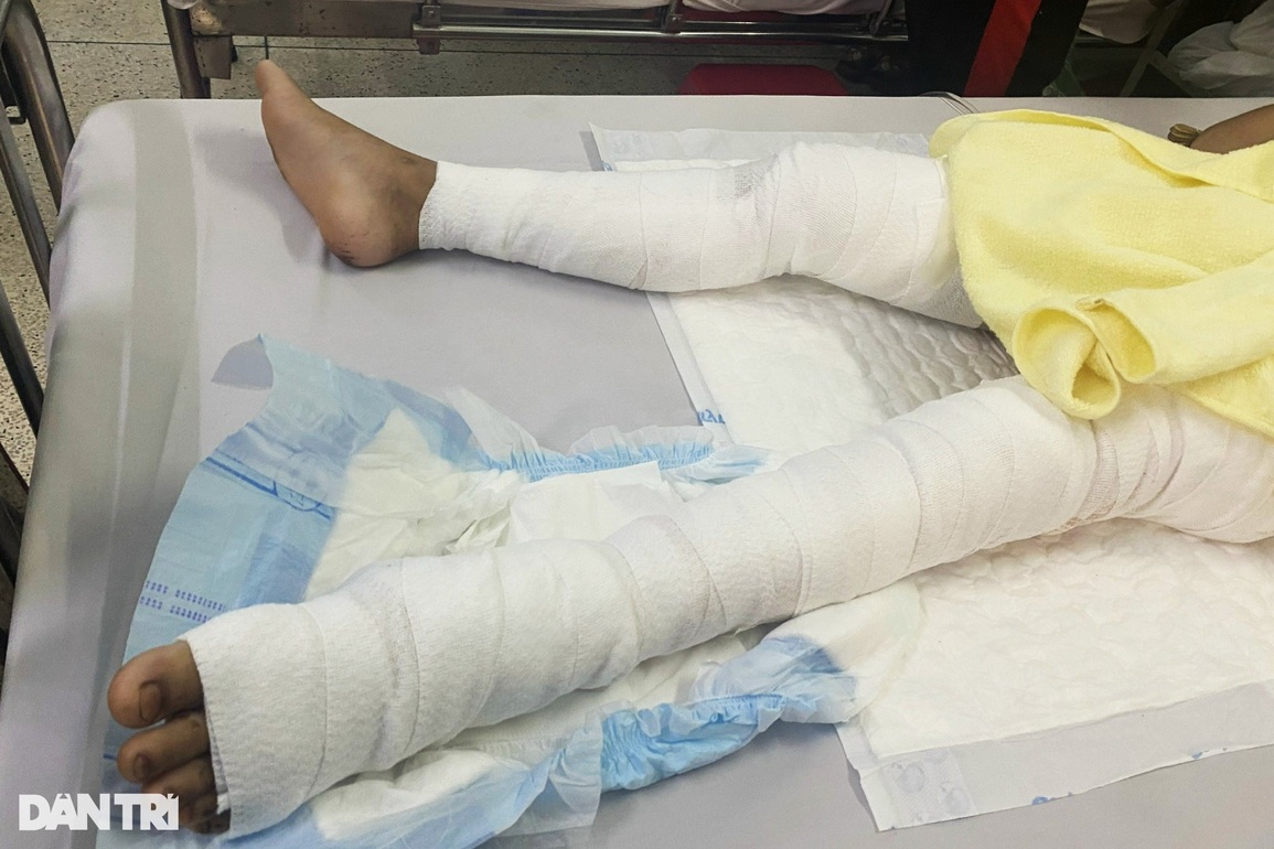 Mẹ nghèo nén nỗi đau thấu trời mất con út, lo tiền cứu con lớn nguy kịch - 4 Mẹ nghèo nén nỗi đau thấu trời mất con út, lo tiền cứu con lớn nguy kịch - 4