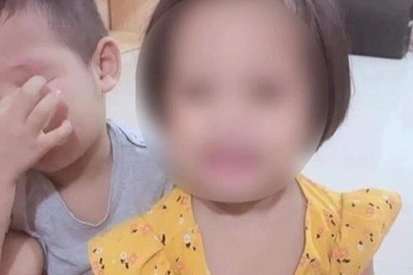 Lãnh đạo Cục cảnh sát hình sự nói về vụ bé gái 3 tuổi bị đóng đinh vào đầu