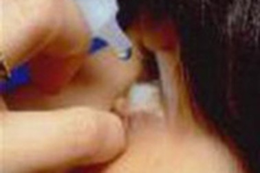 Nhỏ thuốc mắt quá nhiều có thể bị mù