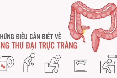 [Inforgraphics]: Phòng ngừa ung thư đại trực tràng hiệu quả