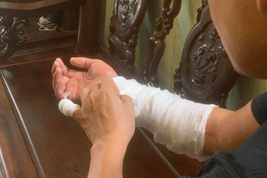 Khởi tố vụ người đàn ông bị chém đứt lìa cánh tay ở Hà Nội