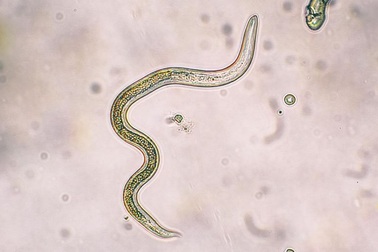 Khách nam bị ký sinh trùng chui vào “chỗ hiểm” và đẻ trứng