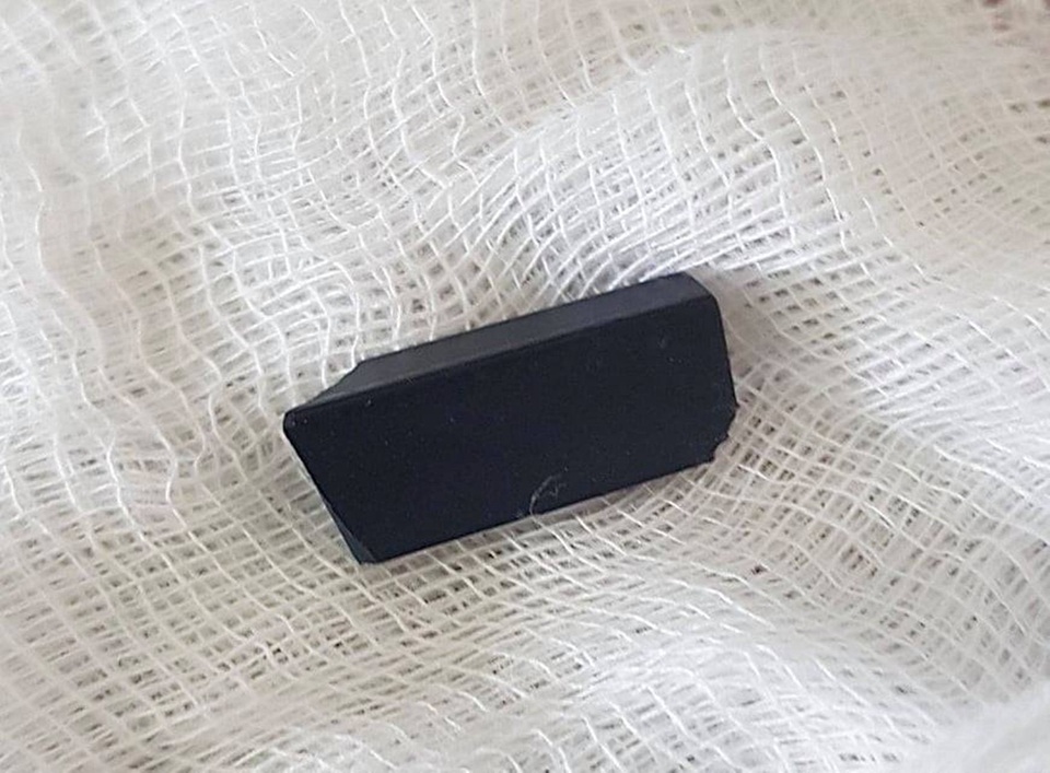 Cháu bé 3 tuổi nuốt nút điều khiển tivi vào khí quản - 2 Cháu bé 3 tuổi nuốt nút điều khiển tivi vào khí quản - 2