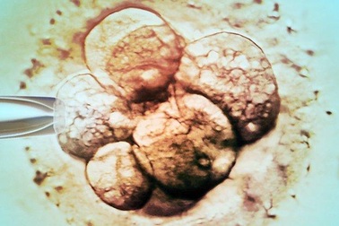 Em bé được sinh ra từ trứng đông lạnh của người sống sót sau ung thư