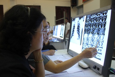 “Truy” bằng chứng về việc sử dụng tấm lợp fibro xi măng gây ung thư