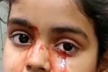 Bé gái 11 tuổi khóc ra máu ở Ấn Độ