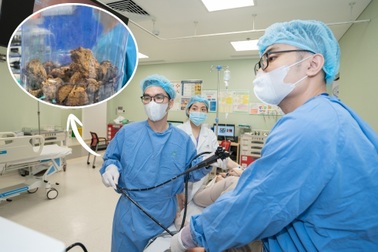 Đau bụng quằn quại vì khối bã thức ăn 15cm chèn ép, gây loét dạ dày