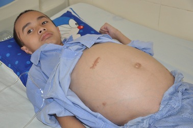 4 lần mổ não, tính mạng cậu bé 10 tuổi như ngọn đèn trước gió