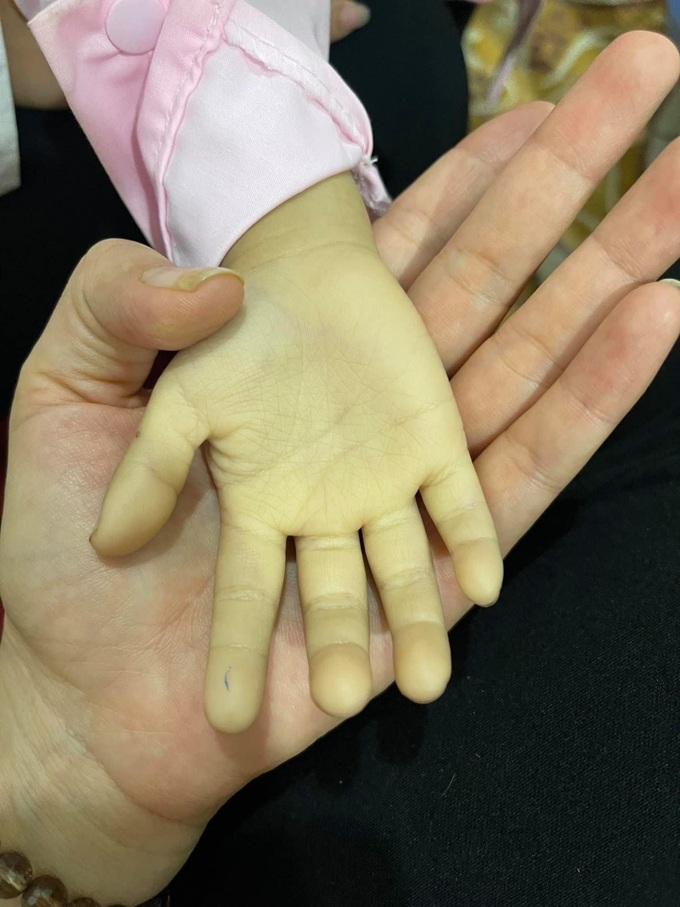 Bàn tay của bé xanh lét