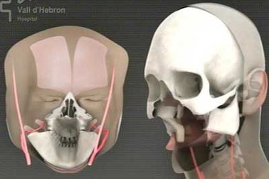 Lần đầu tiên cấy ghép toàn bộ gương mặt