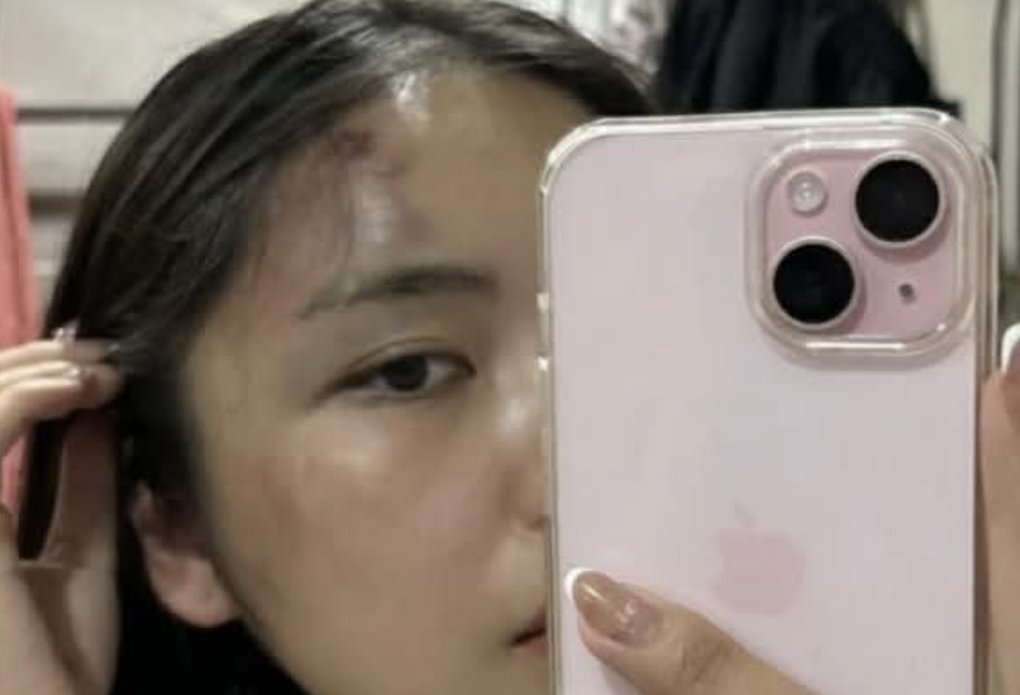 Công an điều tra vụ người phụ nữ tố bị chồng hành hung tại chung cư - 1