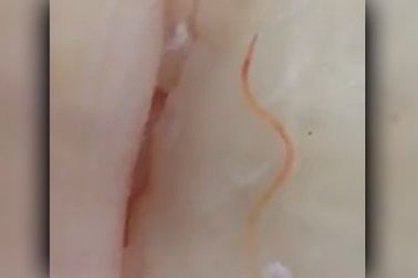 Phát hiện trong cá ở siêu thị có giun còn sống