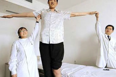 Chùm ảnh: Gặp “đối thủ” của người cao nhất thế giới