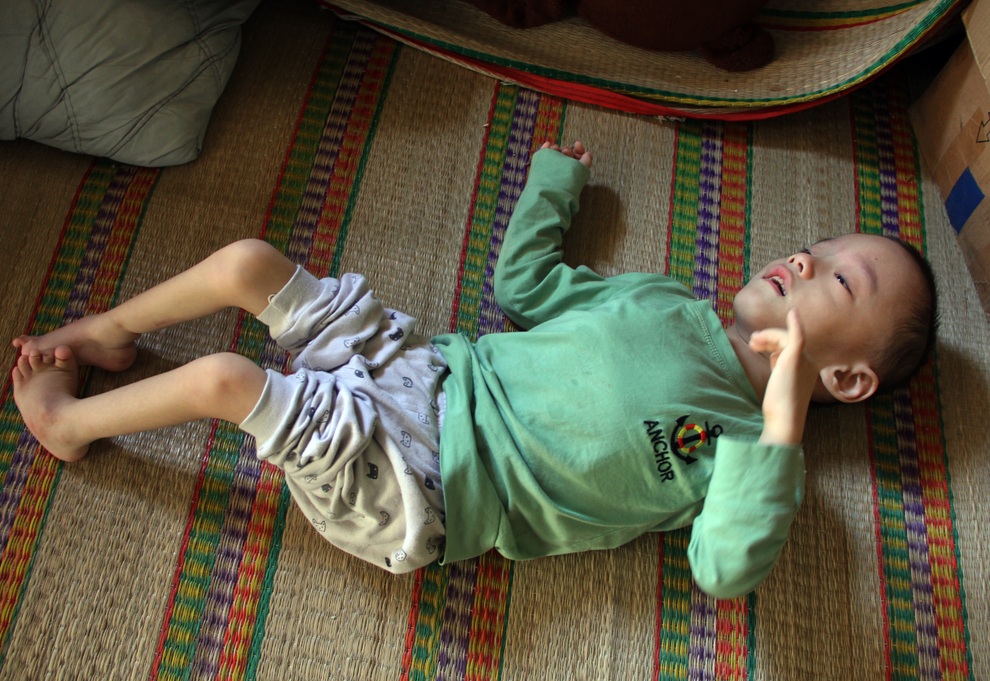 Bé trai 6 tuổi với đôi chân khòeo được bạn đọc giúp đỡ hơn 168 triệu đồng - 2 Bé trai 6 tuổi với đôi chân khòeo được bạn đọc giúp đỡ hơn 168 triệu đồng - 2