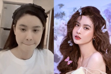 Trương Quỳnh Anh khoe nhan sắc xinh đẹp sau phẫu thuật tuyến giáp