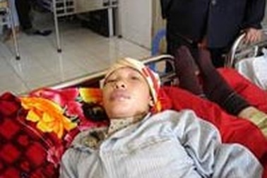 Phù Quinkce có thể gây tử vong