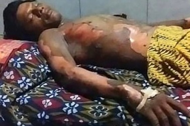 Vợ nhẫn tâm thiêu sống chồng vì bị từ chối đưa mật khẩu mở khóa điện thoại