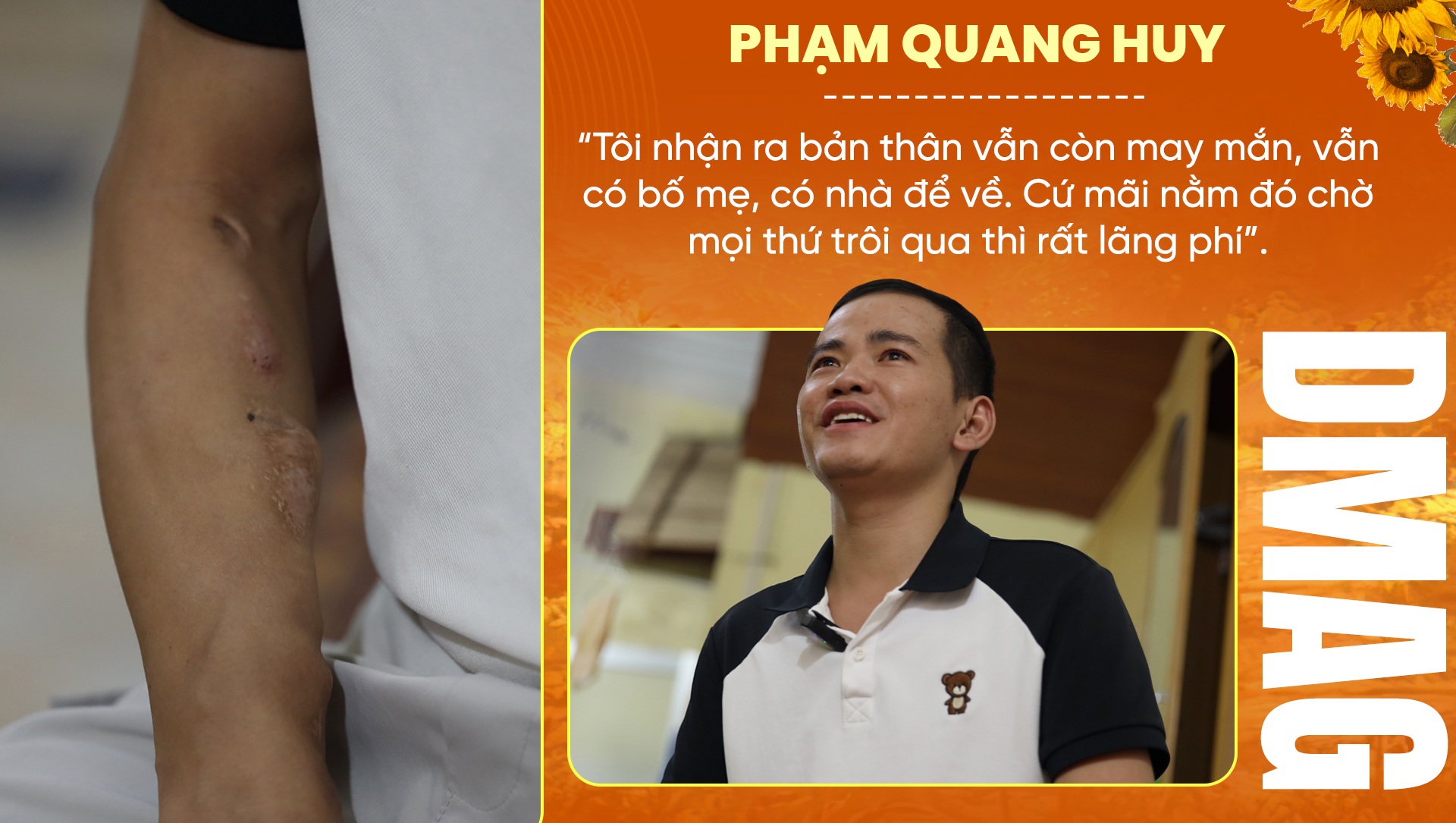 9X suy thận chống nạng làm TikTok, 8 năm cãi số từ phòng trọ 4m2 - 13 9X suy thận chống nạng làm TikTok, 8 năm cãi số từ phòng trọ 4m2 - 13