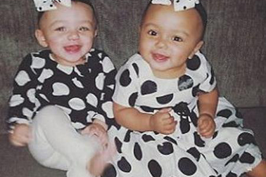 Cặp song sinh khác màu da đón sinh nhật đầu tiên