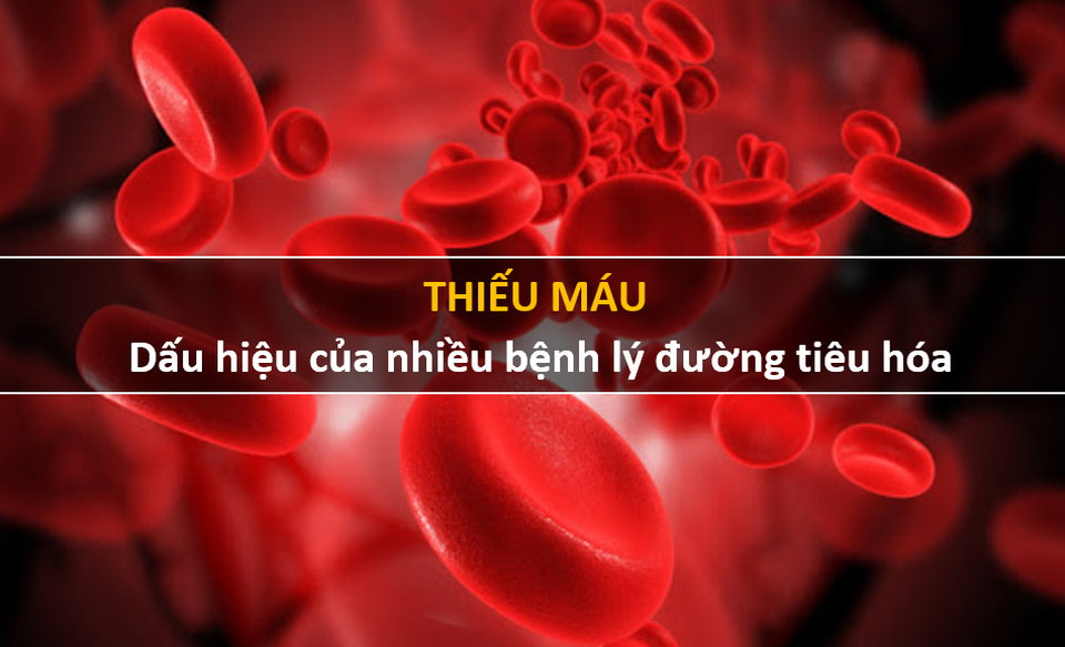 Đi ngoài phân đen: Đừng vội mừng vì nghĩ rằng cơ thể giải độc tốt! - 3 Đi ngoài phân đen: Đừng vội mừng vì nghĩ rằng cơ thể giải độc tốt! - 3