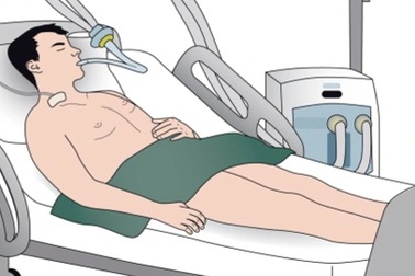 "Thủ phạm" gây tử vong tự nhiên hàng đầu, 100.000 người có 52 ca gặp phải