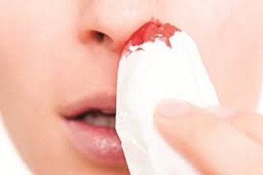 Những dấu hiệu cảnh báo ung thư máu nguy hiểm