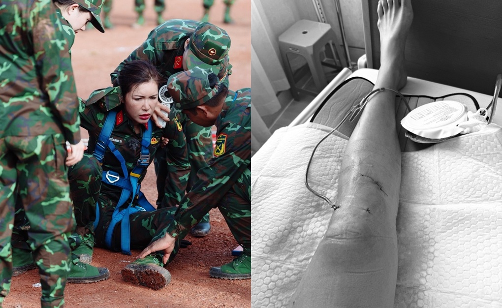Minh Tú gặp chấn thương nặng, chồng Tây kề cận chăm sóc tận tình - 1 Minh Tú gặp chấn thương nặng, chồng Tây kề cận chăm sóc tận tình - 1